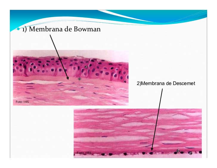 1) Membrana de Bowman




                        2)Membrana de Descemet
 